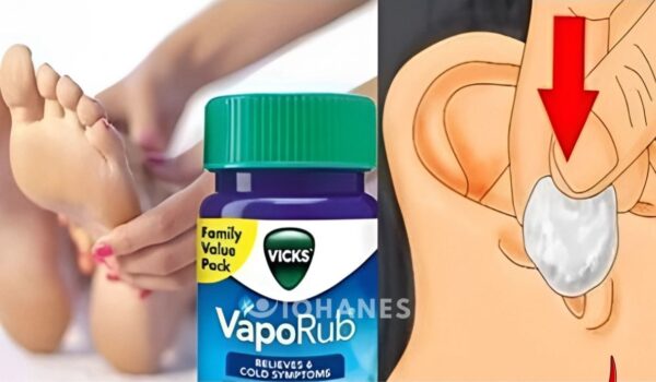 Los Efectos y Aplicación Correcta de Vicks VapoRub en Cinco Partes del Cuerpo para un Alivio Óptimo