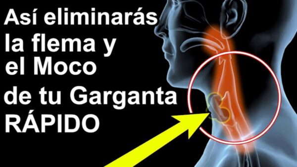 4 Remedios Caseros Eficaces para Eliminar el Moco y la Flema en la Garganta, Sinusitis y Rinitis