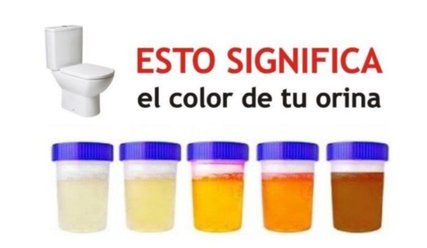 7 Cosas que el Color de tu Orina Dice sobre tu Salud