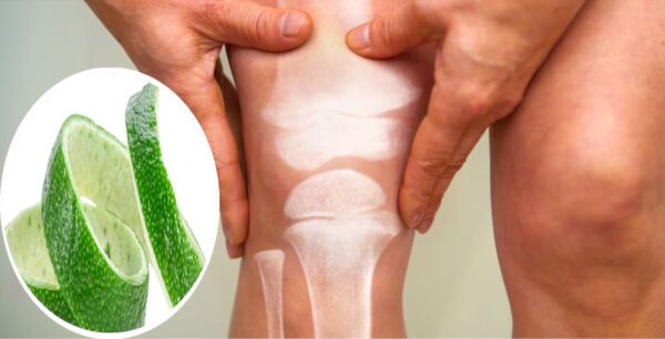 El Limón para Dolores de Rodilla, Artritis y Dolores de Espalda