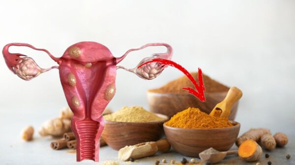 Remedios Naturales para Quistes, Fibromas y Miomas