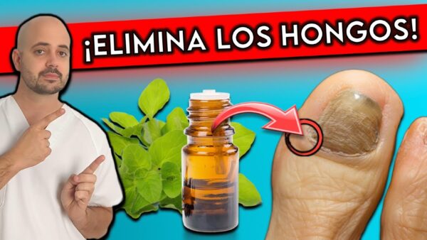 5 Remedios Caseros para Eliminar Hongos en las Uñas y la Piel