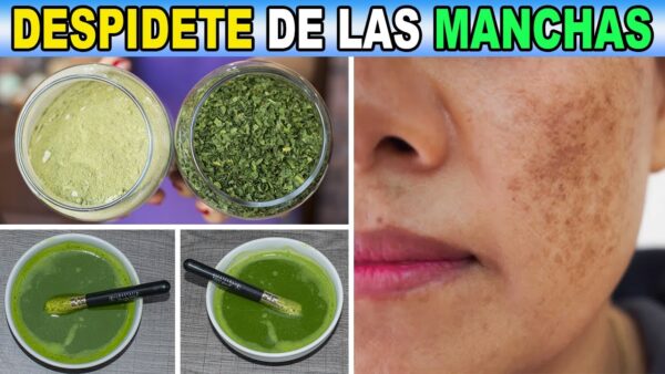 Perejil: El Secreto Natural para Reducir Manchas y Arrugas en tu Piel