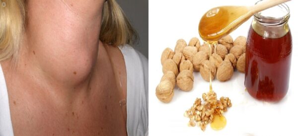 Mejora la Salud de tus Tiroides de Forma Natural con Este Remedio de Miel y Nueces