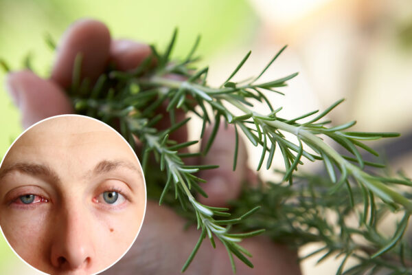 "Cómo el Romero Puede Ayudar a Combatir Conjuntivitis, Cataratas y Glaucoma de Forma Natural"
