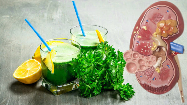 Jugos o Licuados Para Quistes en el Riñón y en Otras Partes del Cuerpo