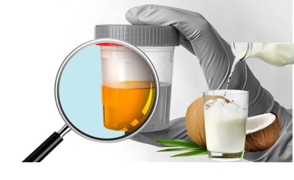 "Orina: Qué Dice su Color y Cómo Mejorarla"