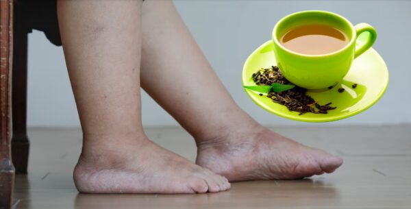 El mejor té para piernas hinchadas: diurético natural para tobillos y pies