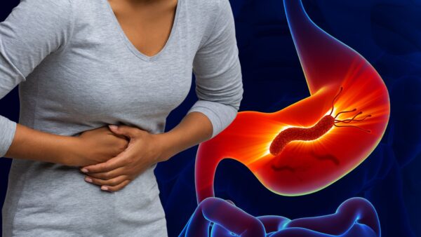 Helicobacter pylori: Qué es, síntomas, consecuencias y 7 remedios caseros para eliminarlo naturalmente