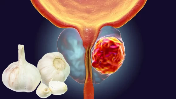 Ajo para la próstata y vejiga: el remedio natural que alivia y regenera