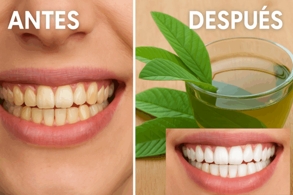 3 formas de usar las hojas de guayaba para caries y dientes blancos