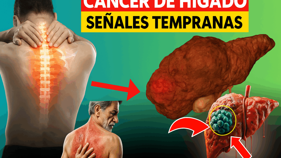 cáncer de hígado