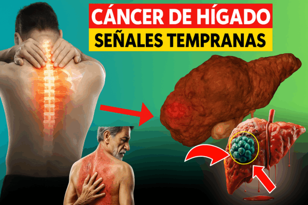 11 señales tempranas de cáncer de hígado que debes conocer