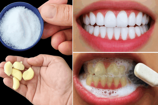 Elimina bacterias y blanquea tus dientes con ajo y sal: receta casera comprobada